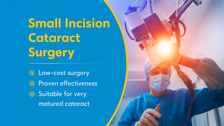 Small Incision Cataract Surgery (SICS): Procedure, Benefits, Recovery & Cost